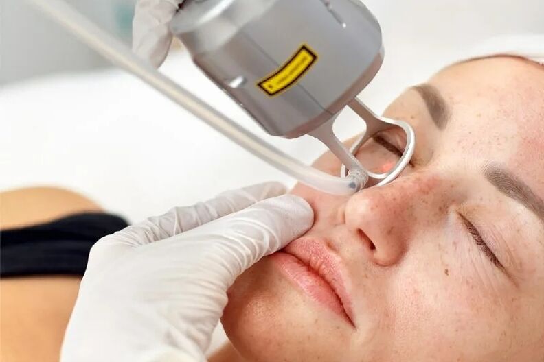 Plataforma láser para a corrección da pel facial